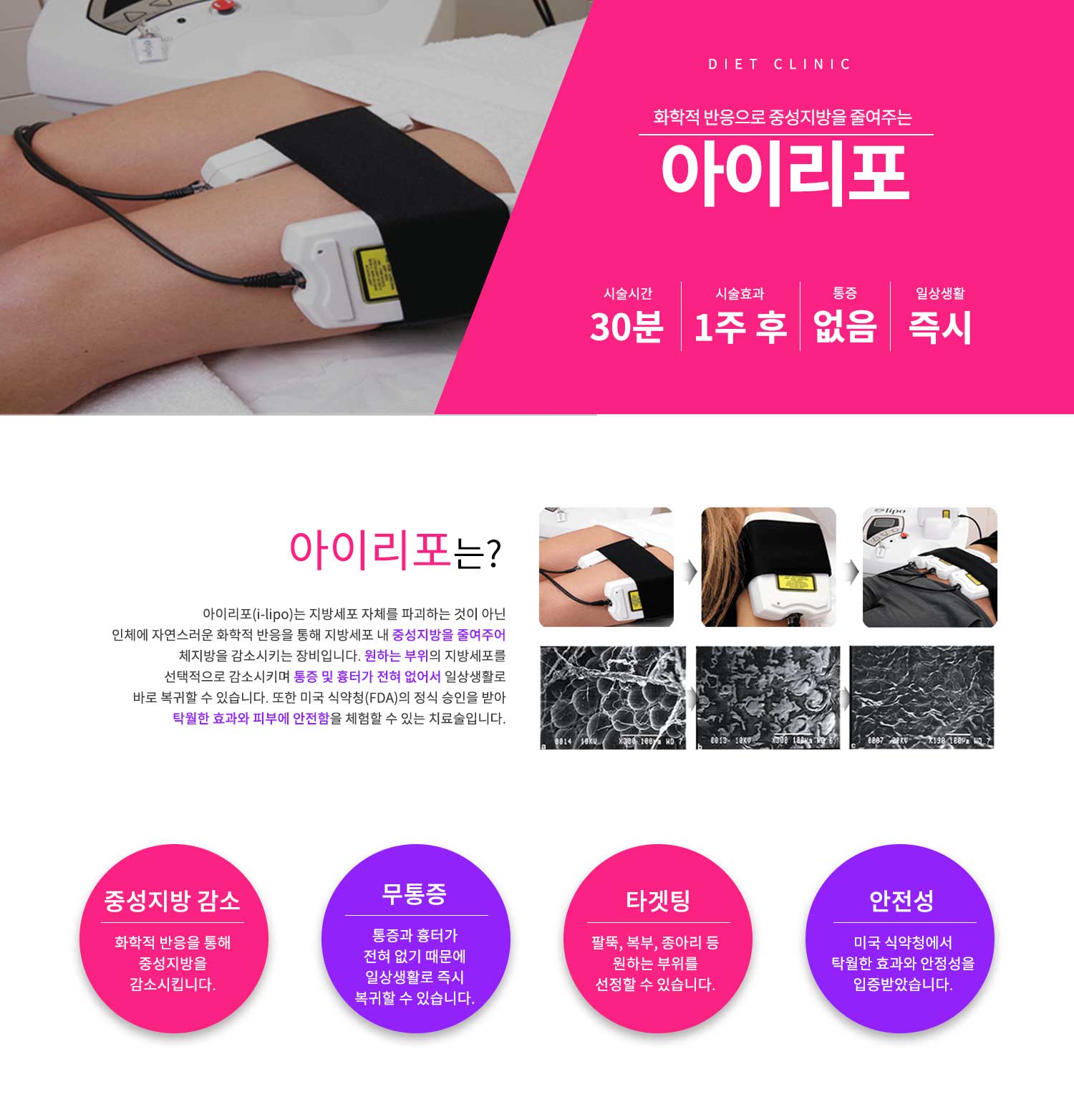 아이리포
